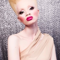 Why Gert-Johan Chose A Girl With Albinism As The Face Of His New Collection!